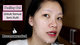 PEELING GEL TERNYAMAN DAN TERENAK YANG PERNAH AKU COBA  REVIEW AESTURA ATOBARRIER PEELING GEL [upl. by Vanna]