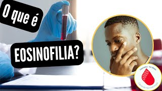 O que são EOSINÓFILOS aumentados EOSINOFILIA GEYDSON CRUZ MDMSc [upl. by Ahseim348]