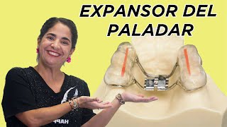 Expansor del paladar [upl. by Gerhard]