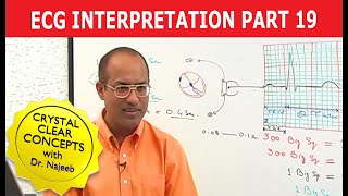 EKG or ECG Interpretation  Part 1920 [upl. by Cela52]