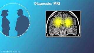 Diagnosis of Multiple Sclerosis [upl. by Maurise]