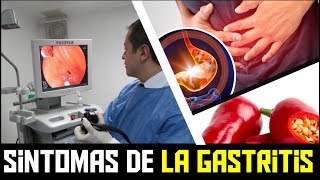 SINTOMAS de la GASTRITIS AGUDA [upl. by Fidelis]