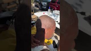 World’s driest scalp funny dryscalp haircut dandruff [upl. by Guinna966]