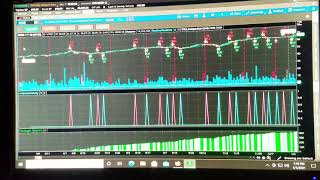 TTM SCALPER BOT PLOT amp WATCHLIST PART1 [upl. by Xela]