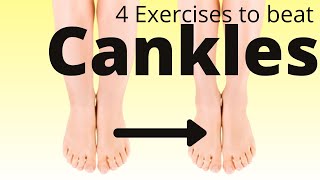 4 exercises to define your calves  lose cankles fast [upl. by Alexandro]