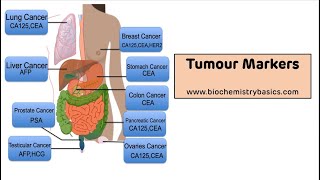 Tumour Markers  Tumour Markers Biochemistry [upl. by Merlin]