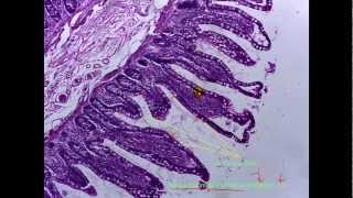 Simple Epithelial Tissuesvideo 1 of 2 [upl. by Haduhey]