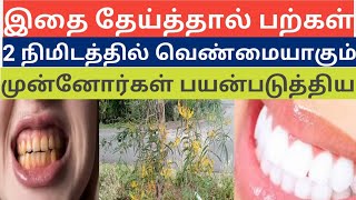 இது பல் கறைகளைப் போக்கி பல்லை வெண்மையாக மாற்றும் herbal tooth powder home remedy [upl. by Ware75]