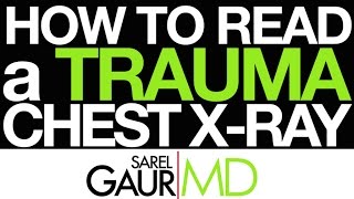 How to Read a Trauma Chest Xray in 3 Minutes [upl. by Rochell723]