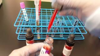 Blood Banking Antibody Screen Set up Part 1 [upl. by Eidnarb]