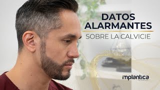 👉 Calvicie en Hombres ⚠️ Datos ALARMANTES ⚠️ [upl. by Aluk]