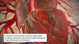 Aortic Stenosis Progression [upl. by Grosberg59]