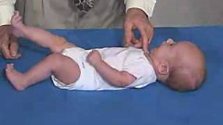 Neurology Exam 3 Month Primitive ReflexesRoot [upl. by Claribel]