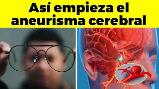 ¡ASI EMPIEZA UN ANEURISMA CEREBRAL que te puede MATAR  y nadie te lo dice [upl. by Eyr]