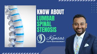 Are you suffering from back pain due to Lumbar Spinal Stenosis [upl. by Aihsas]