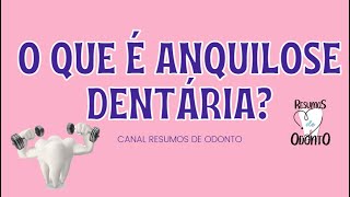 O que é anquilose dentária [upl. by Esinev466]