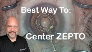 Best Techniques for Centering Zepto® Every Time  The Cataract Fellowship [upl. by Noiramaj]