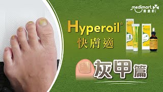 灰甲篇  Hyperoil快膚適 全方位殺滅真菌  Medimart樂康軒 [upl. by Nosyarg855]