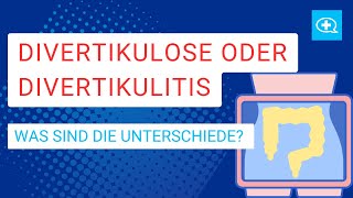 Volkskrankheit Divertikulose  wann wird die Darmerkrankung gefährlich [upl. by Eniffit]