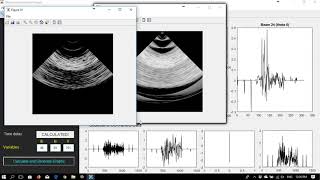 Ultrasound Simulation Application  MatLab [upl. by Inajar]