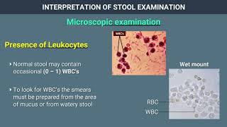 Interpretation of Stool Examination [upl. by Brunhild435]