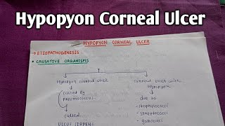 HYPOPYON CORNEAL ULCER  OPHTHALMOLOGY  A K KHURANA [upl. by Ezequiel]