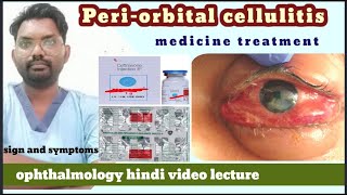 orbital cellulitis  orbital disease  orbital cellulitis  orbitalcellulitismedicinetreatment [upl. by Kelton519]