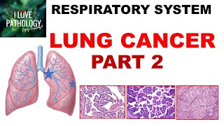 LUNG CANCER  Part 2 Morphology Clinical features [upl. by Shulem]