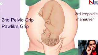 Leopolds Maneuvers  Obstetric Grips  Abdominal Palpation  Nursing Lecture [upl. by Dympha]