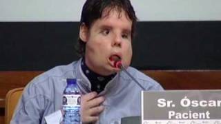 Worlds first full face transplant man appears on TV [upl. by Ijnek]