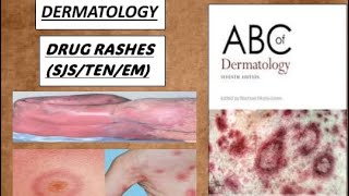 DERMATOLOGY DRUG RASHES Steven Johnson syndrome toxic epidermal necrolysis erythema multiform [upl. by Wynnie]