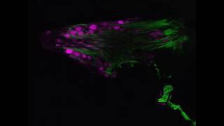 Locust Mesothoracic Fermoral Chordotonal Organ [upl. by Mungovan]