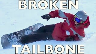 BROKEN TAILBONE SNOWBOARDING [upl. by Arrol]