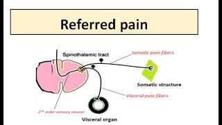 REFERRED PAIN [upl. by Lah]