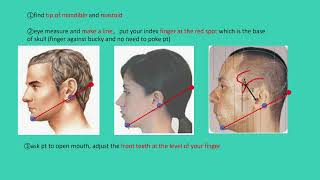 Xray odontoid view positioningopen mouth Cspine [upl. by Intisar]