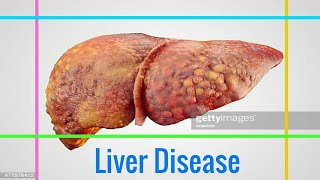 LIVER DISEASE  What Are the Early Signs of Liver Disease You Shouldnt Ignore [upl. by Ttreve]