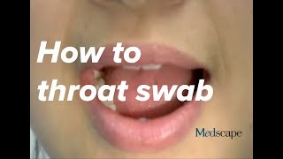 How to perform a throat swab on a patient [upl. by Ainaj499]