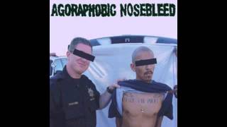 Agoraphobic Nosebleed  Home Invasion [upl. by Nekcarb186]