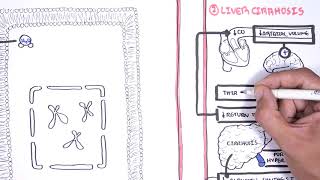 Hyponatraemia Hyponatremia  classification causes pathophysiology treatment [upl. by Dew]