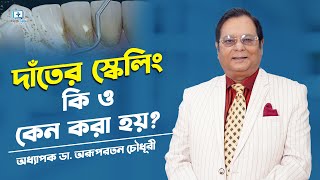 দাঁতের স্কেলিং কি ও কেন করা হয় Dental Scaling and Polishing [upl. by Noryv788]