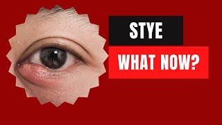 I have a STYE What now eyes eyehealth [upl. by Matlick932]