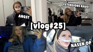 meine Nasen OP 😳  Vorbereitungen amp wie es mir danach geht vlog25 ⎮ ZCLINA [upl. by Ydnamron463]