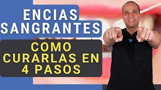 ENCIAS INFLAMADAS y SANGRANTES 😳 Como CURARLAS en 4 PASOS Funciona 😃✌ [upl. by Roe]