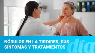 Nódulos en la tiroides sus síntomas y tratamientos [upl. by Yhprum]