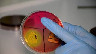 The Staphylococci and The Streptococci Microbiology Laboratory Practical Part [upl. by Ahsenor]