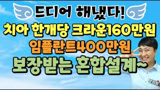 ☆드디어 해냈다☆ 치아한개당 크라운160만 임플란트400만 혼합설계 순서에 맞게 아니면 탈락 [upl. by Frankhouse]