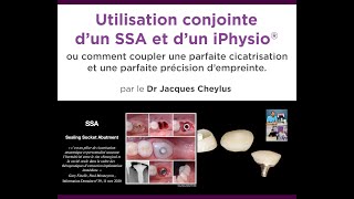 Utilisation conjointe dun SSA et dun iphysio® [upl. by Fleece]