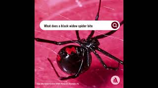 What Does A Black Widow Spider Bite Feel Like [upl. by Karlis]