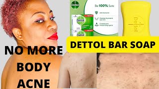 How To Use Dettol Antiseptic Bar Soap To Clear Body Acne And Rashes For Good [upl. by Drucy]