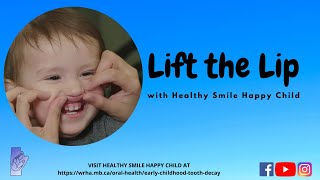 Lift the Lip with Healthy Smile Happy Child Preventing Early Childhood Caries [upl. by Corrine800]